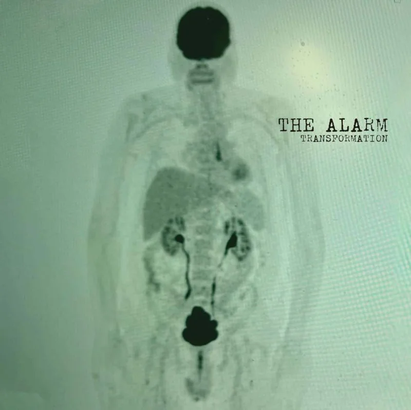 The Alarm - Transformation